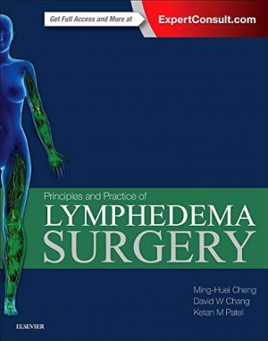 Principles and Practice of Lymphedema Surgery