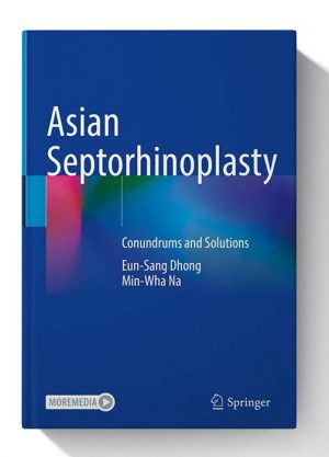 Asian Septorhinoplasty Conundrums and Solutions 1st ed. 2021 Edition 1