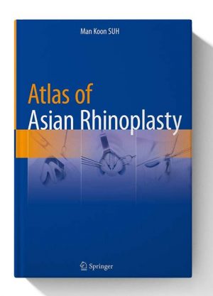 Atlas of Asian Rhinoplasty 1st ed. 2018 Edition 1