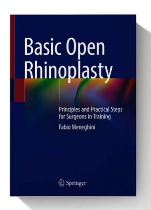 Basic Open Rhinoplasty Principles and Practical Steps for Surgeons in Training 1st ed. 2021 Edition 1