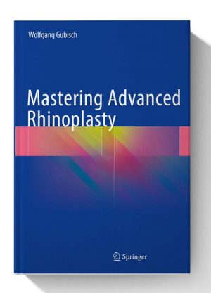 Mastering Advanced Rhinoplasty 1st ed. 2018 Edition 1