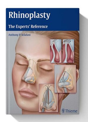 Rhinoplasty The Experts Reference Illustrated Edition 1