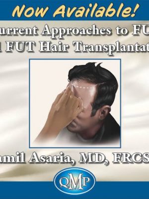 Current Approaches to FUE and FUT Hair Transplantation