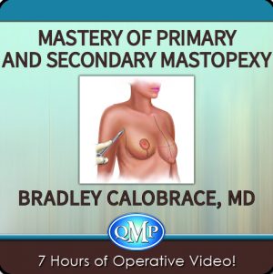 Mastery of Primary and Secondary Mastopexy e1715197194378