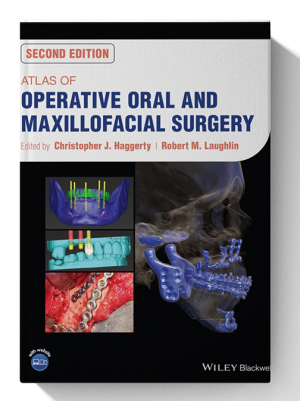 Atlas of Operative Oral and Maxillofacial Surgery 2nd Edition