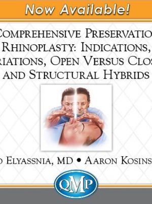 Comprehensive Preservation Rhinoplasty