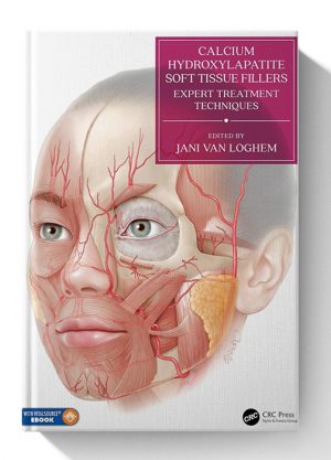 Calcium Hydroxylapatite Soft Tissue Fillers Expert Treatment Techniques 1st Edition