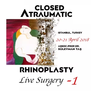 Closed Atraumatic Rhinoplasty Live Surgery DVD 1