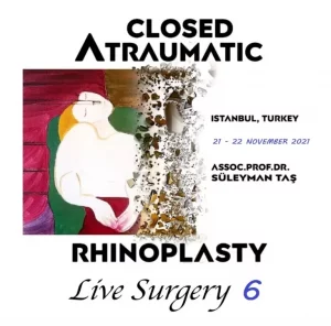 Closed Atraumatic Rhinoplasty Live Surgery DVD 6 2021